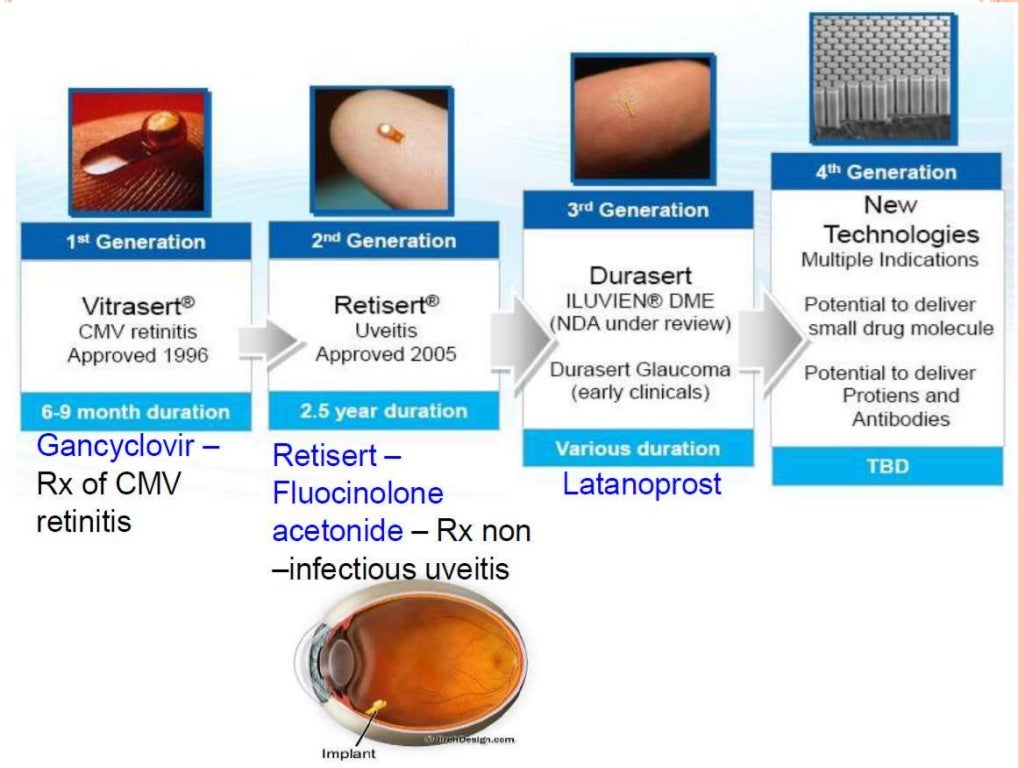 novel-drug-delivery-system