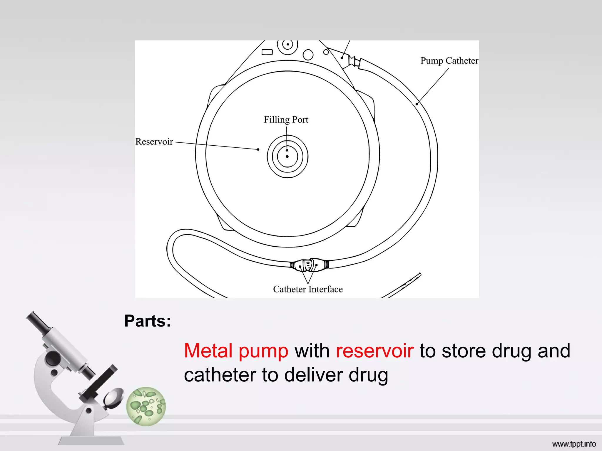 Parts:
Metal pump with reservoir to store drug and
catheter to deliver drug