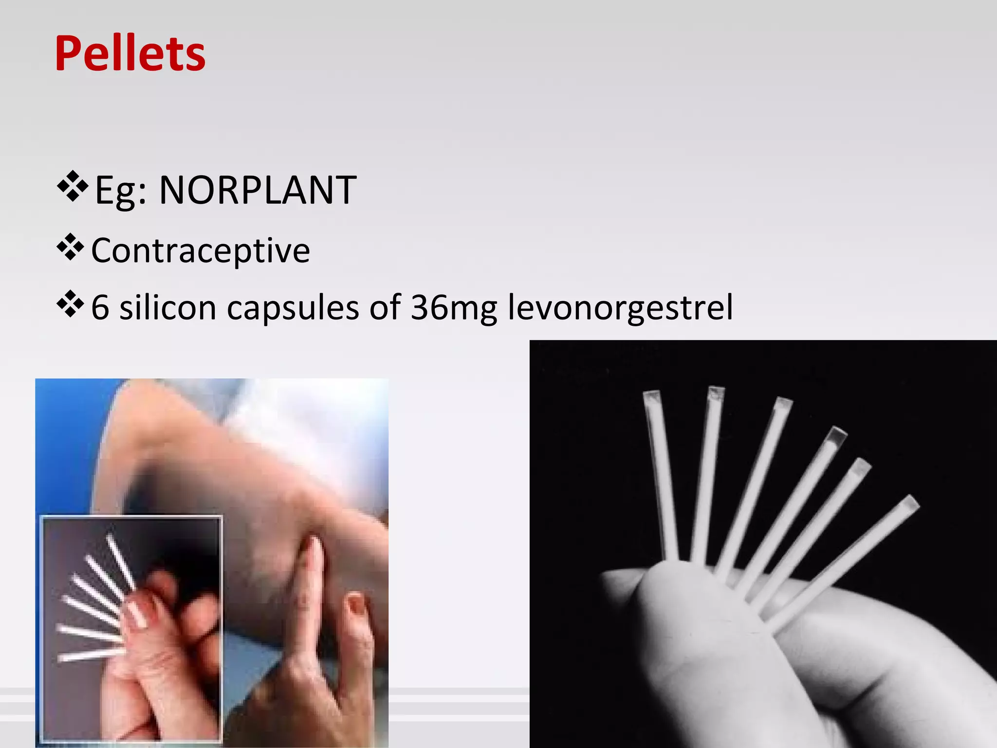 Pellets
Eg: NORPLANT
Contraceptive
6 silicon capsules of 36mg levonorgestrel