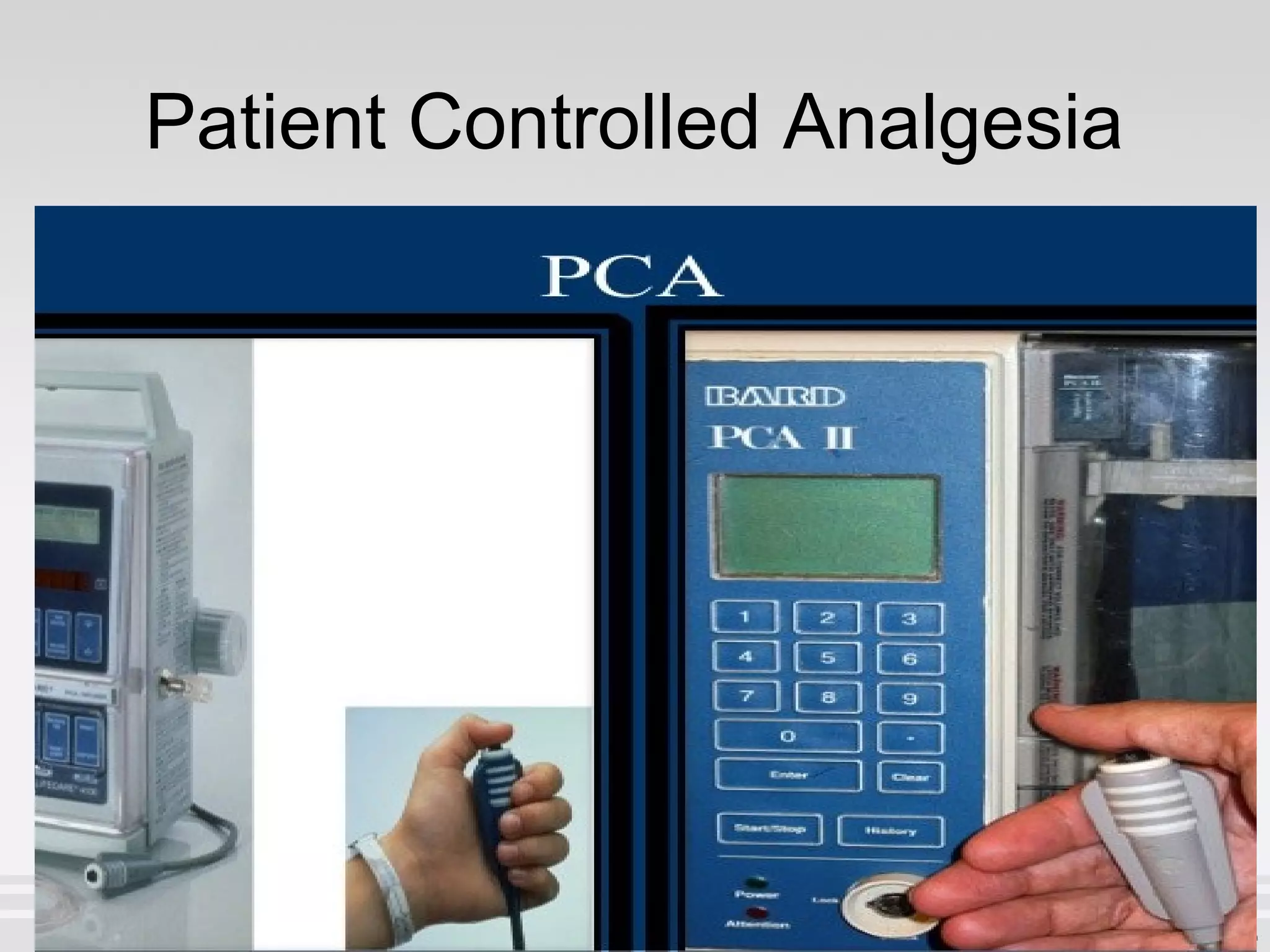 Patient Controlled Analgesia