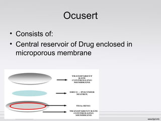 Ocuset Formulation Newer Drug Delivery Systems | PPT