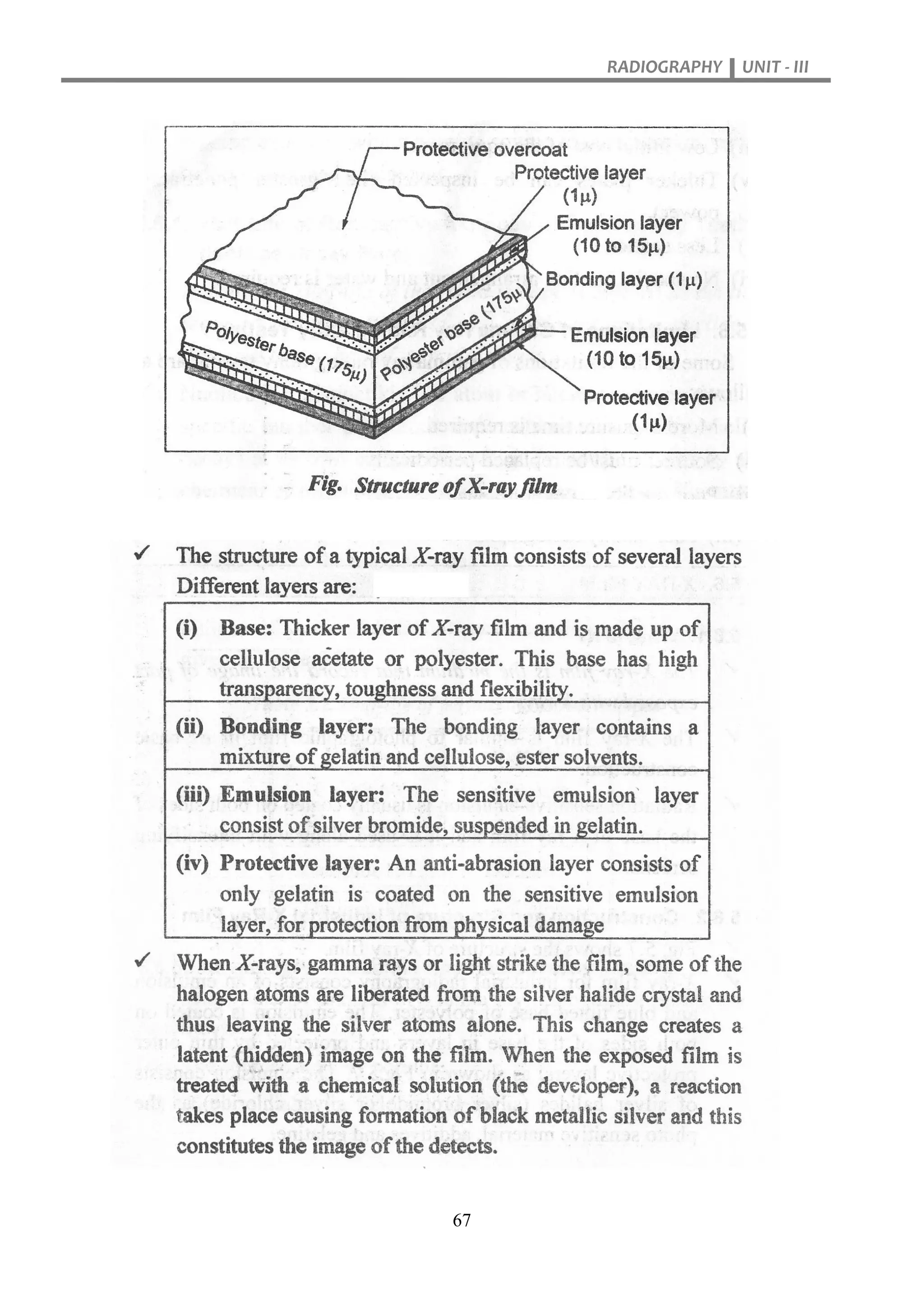 RADIOGRAPHY UNIT - III
67
 