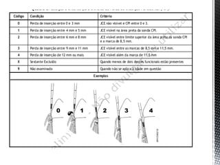 íNdices de condição periodontal