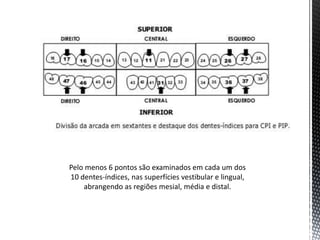 Pelo menos 6 pontos são examinados em cada um dos
10 dentes-índices, nas superfícies vestibular e lingual,
    abrangendo as regiões mesial, média e distal.
 