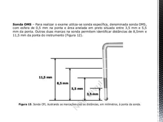 íNdices de condição periodontal