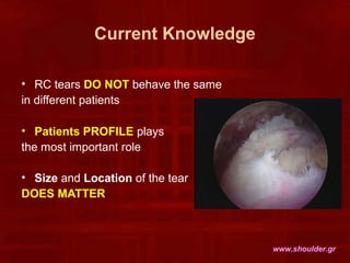 Current Knowledge
• RC tears DO NOT behave the same
in different patients
• Patients PROFILE plays
the most important role...
