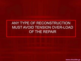 ANY TYPE OF RECONSTRUCTION
MUST AVOID TENSION OVER-LOAD
OF THE REPAIR
www.shoulder.gr
 