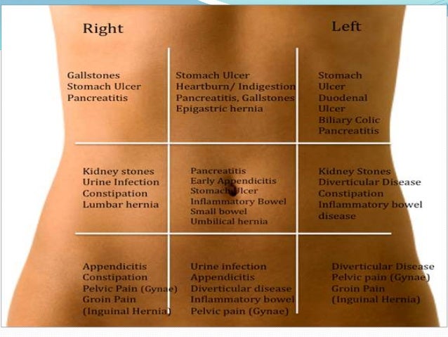 distended abdomen acute abdomen distended abdomen acute abdomen