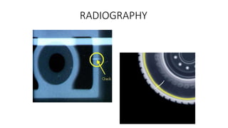 RADIOGRAPHY
 
