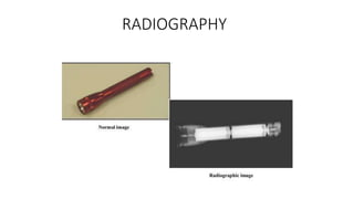 RADIOGRAPHY
 