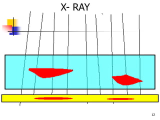 12
X- RAY
 