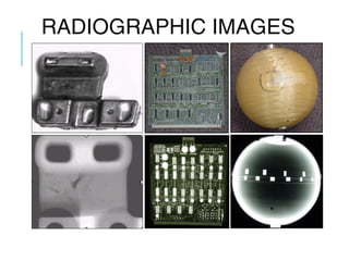 RADIOGRAPHIC IMAGES

 