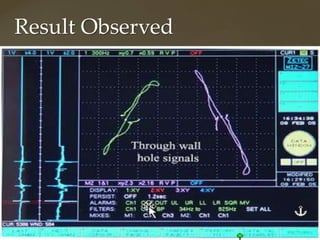 Tubular Non Destructive techniques (Remote field testing and Internal ...