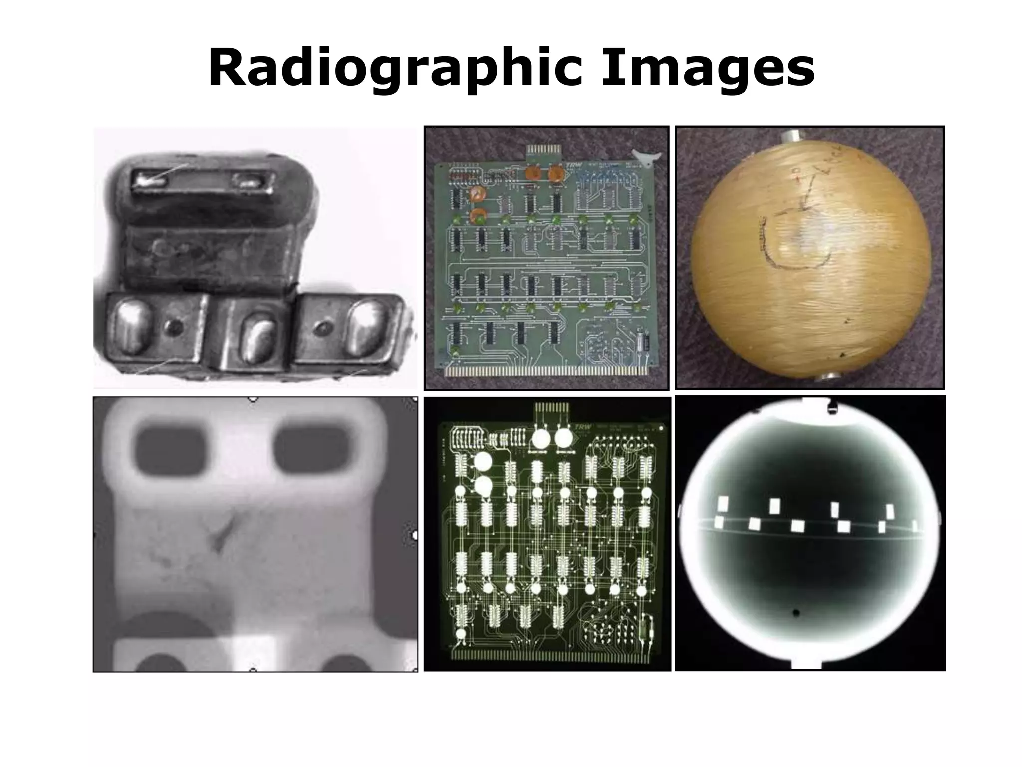 Radiographic Images
 