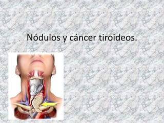 Nódulos y cáncer tiroideos.
 