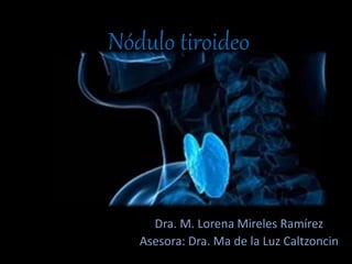 Nódulo tiroideo
Dra. M. Lorena Mireles Ramírez
Asesora: Dra. Ma de la Luz Caltzoncin
 