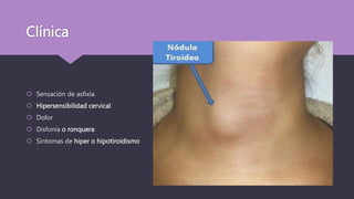 Clínica
 Sensación de asfixia
 Hipersensibilidad cervical
 Dolor
 Disfonía o ronquera
 Síntomas de hiper o hipotiroidismo
 