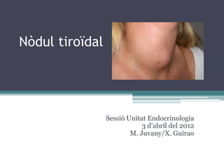 Nòdul tiroïdal




                 Sessió Unitat Endocrinologia
                             3 d’abril del 2012
                         M. Juvany/X. Guirao
 