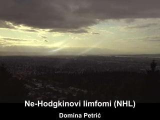 Ne-Hodgkinovi limfomi (NHL)
Domina Petrić
 