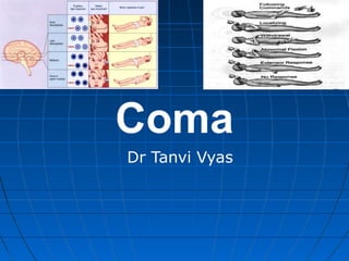 Coma
Dr Tanvi Vyas
 