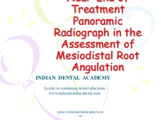 Near-End of
Treatment
Panoramic
Radiograph in the
Assessment of
Mesiodistal Root
Angulation
www.indiandentalacademy.co
m
INDIAN DENTAL ACADEMY
Leader in continuing dental education
www.indiandentalacademy.com
 