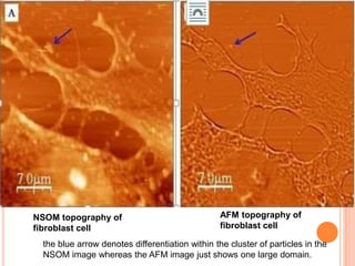 NSOM topography of
fibroblast cell
AFM topography of
fibroblast cell
the blue arrow denotes differentiation within the cluster of particles in the
NSOM image whereas the AFM image just shows one large domain.
 