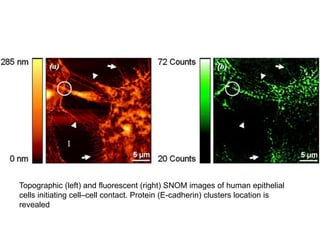 Topographic (left) and fluorescent (right) SNOM images of human epithelial
cells initiating cell–cell contact. Protein (E-cadherin) clusters location is
revealed
 