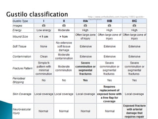 http://www.orthobullets.com/trauma/1003/gustilo-
classification
 