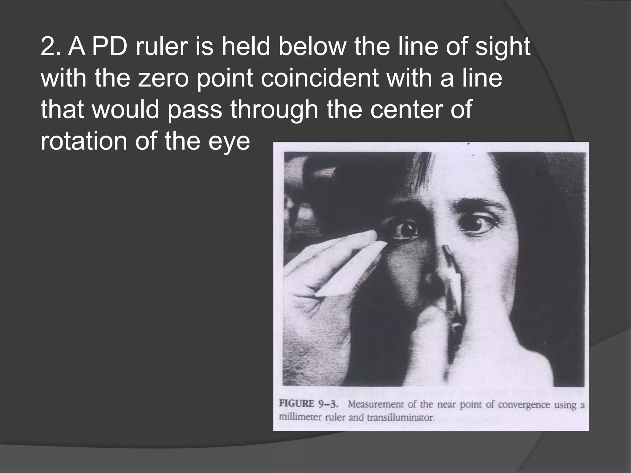 2. A PD ruler is held below the line of sight
with the zero point coincident with a line
that would pass through the center of
rotation of the eye

 