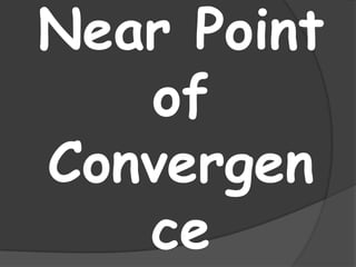 Near Point
of
Convergen
ce

 