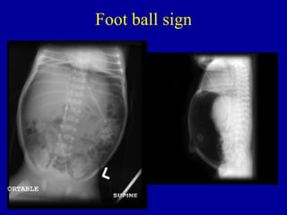 Foot ball sign
 