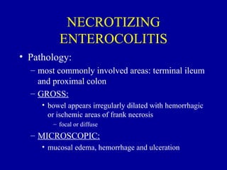 NECROTIZING
          ENTEROCOLITIS
• Pathology:
  – most commonly involved areas: terminal ileum
    and proximal colon
  – GROSS:
     • bowel appears irregularly dilated with hemorrhagic
       or ischemic areas of frank necrosis
        – focal or diffuse
  – MICROSCOPIC:
     • mucosal edema, hemorrhage and ulceration
 
