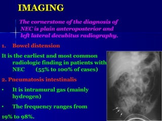 Nec Classification Radiology NEC اشرف حامدi | PPT