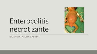 Enterocolitis
necrotizante
RICARDO	FALCÓN SALINAS
 