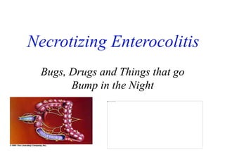 Necrotizing Enterocolitis
Bugs, Drugs and Things that go
Bump in the Night
 