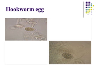 Hookworm egg
 