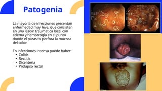 Comprehensive Overview of Parasitic Infections: Necator Americanus and ...