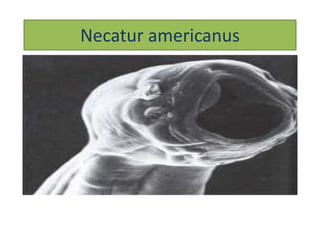 Necatur americanus
 