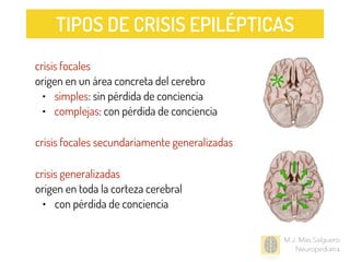 M.J. Mas Salguero
Neuropediatra
crisis focales
origen en un área concreta del cerebro
• simples: sin pérdida de conciencia
• complejas: con pérdida de conciencia
crisis generalizadas
origen en toda la corteza cerebral
• con pérdida de conciencia
crisis focales secundariamente generalizadas
TIPOS DE CRISIS EPILÉPTICAS
 