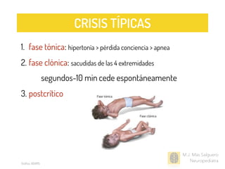1. fase tónica: hipertonía > pérdida conciencia > apnea
2. fase clónica: sacudidas de las 4 extremidades
segundos-10 min cede espontáneamente
3. postcrítico
M.J. Mas Salguero
Neuropediatra
CRISIS TÍPICAS
Gráﬁco: ADAMS
 