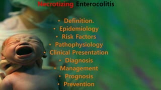 Necrotizing Enterocolitis
• Definition.
• Epidemiology
• Risk Factors
• Pathophysiology
• Clinical Presentation
• Diagnosis
• Management
• Prognosis
• Prevention
 