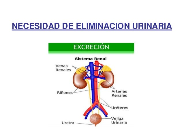 Necesidad de eliminacion