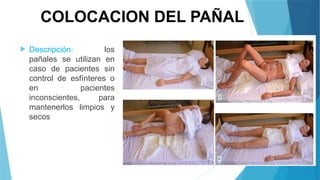 COLOCACION DEL PAÑAL
 Descripción: los
pañales se utilizan en
caso de pacientes sin
control de esfínteres o
en pacientes
inconscientes, para
mantenerlos limpios y
secos
 