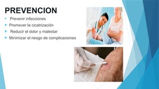 PREVENCION
 Prevenir infecciones
 Promover la cicatrización
 Reducir el dolor y malestar
 Minimizar el riesgo de complicaciones
 