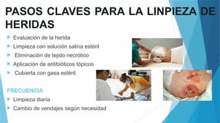 PASOS CLAVES PARA LA LINPIEZA DE
HERIDAS
 Evaluación de la herida
 Limpieza con solución salina estéril
 Eliminación de tejido necrótico
 Aplicación de antibióticos tópicos
 Cubierta con gasa estéril
FRECUENCIA
 Limpieza diaria
 Cambio de vendajes según necesidad
 