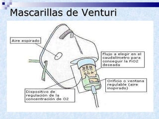 Mascarillas de Venturi 