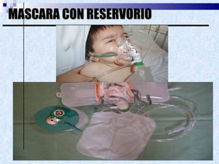 MASCARA CON RESERVORIO 