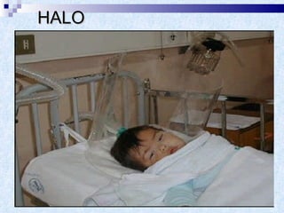 HALO 