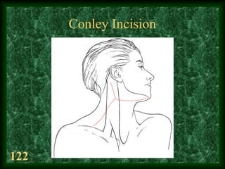 122
Conley Incision
 