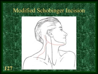 127
Modified Schobinger Incision
 